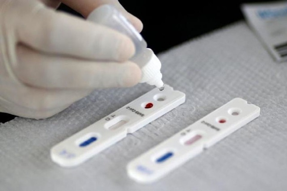 ANS torna obrigatória cobertura de teste para Coronavírus por planos de saúde