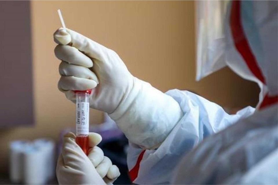 Rondônia ultrapassa 20.000 casos de covid-19 e 499 óbitos
