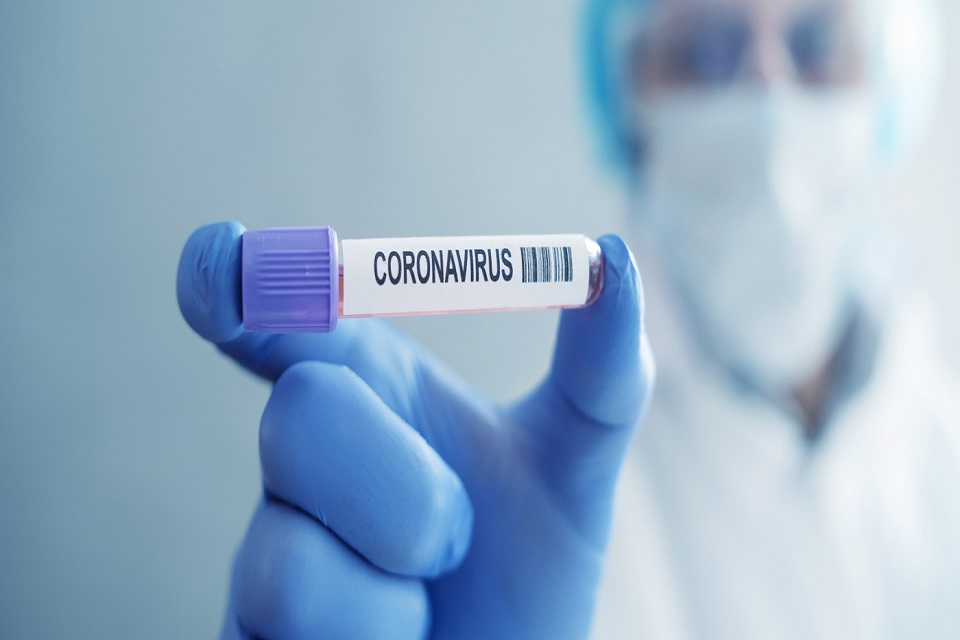 Rondônia: 25.067 casos de Coronavírus com 585 mortes; curados somam 14.391