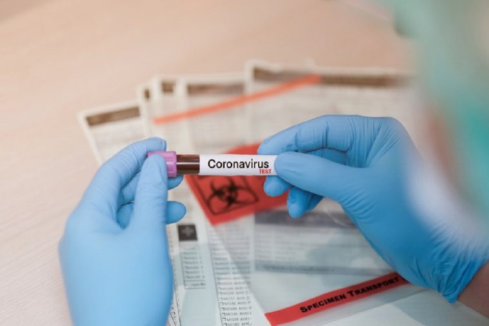 Boletim atualizado sobre coronavírus em Rondônia