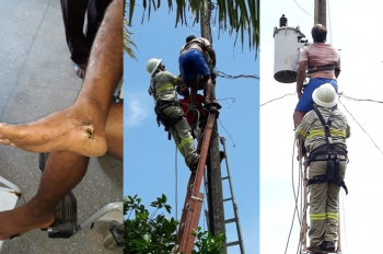 Agricultor escapa da morte após tentar religar energia e sofrer descarga elétrica em poste na zona rural