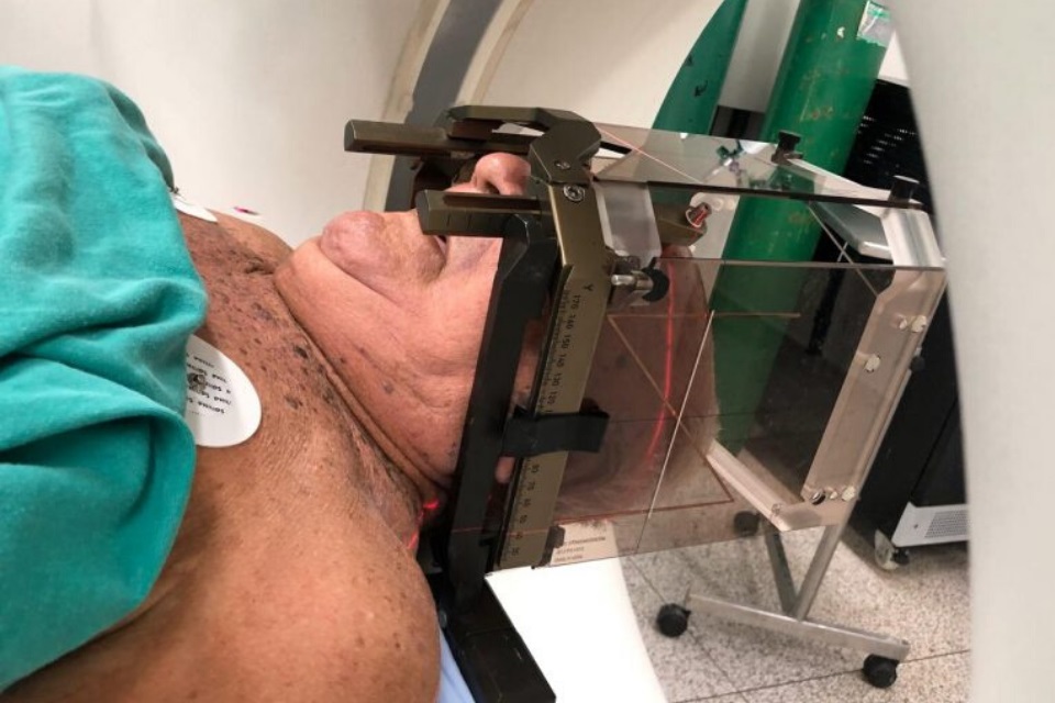 Primeira cirurgia de marca-passo cerebral é realizada em Rondônia pelo SUS no Hospital de Base, em Porto Velho