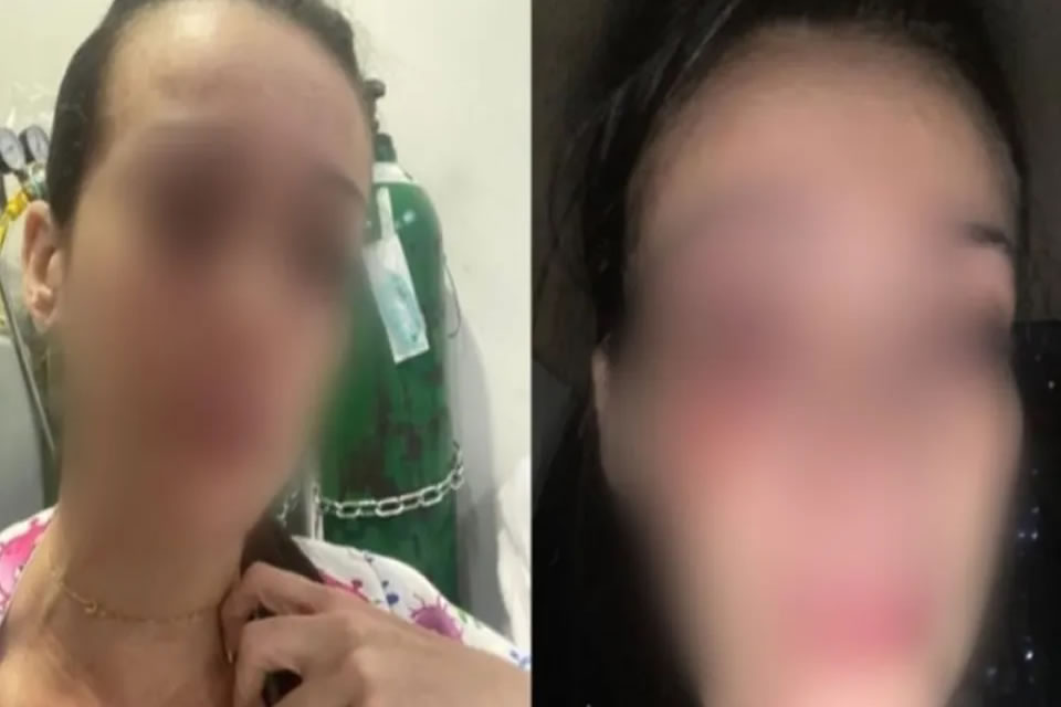 Mãe de paciente agride enfermeira com xingamentos e socos em hospital