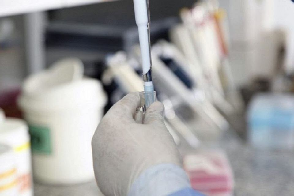 Estado de Rondônia investe em pesquisa para maior eficácia no tratamento de tuberculose