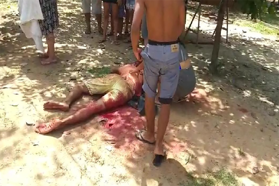 Briga entre irmãos termina com um baleado na cabeça em Porto Velho