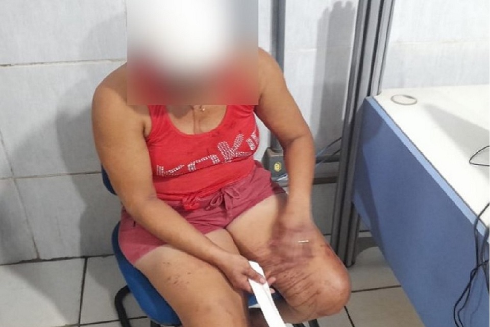 Durante a confusão um amigo tentou conter os ânimos e foi agredido na mão e braço pelo acusado que usou faca e facão